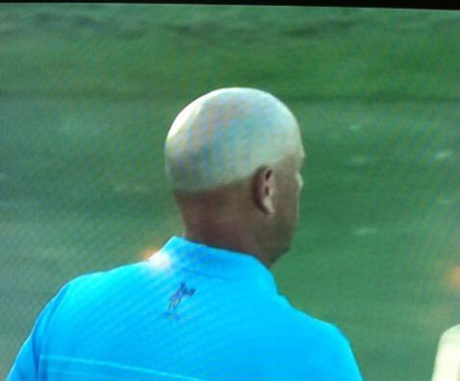 Golfer Tan Secrets: Fix Uneven Skin Tone from Hours on the Course.